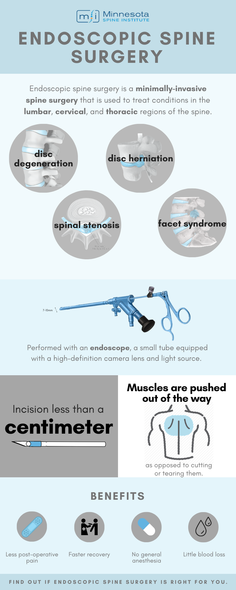 Spinal Stenosis - Minnesota Spine Institute