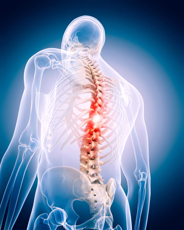 Spinal Back Pain