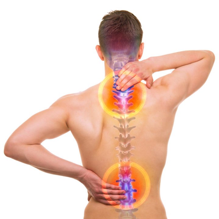 Could you have spinal stenosis?