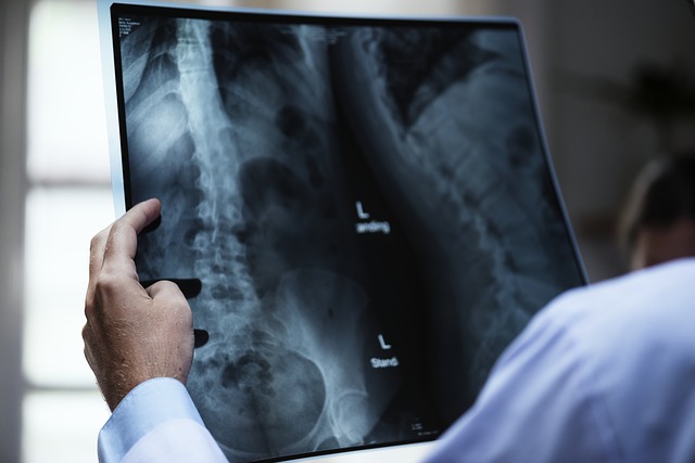 Doctor reviewing x-rays due to patient back pain.